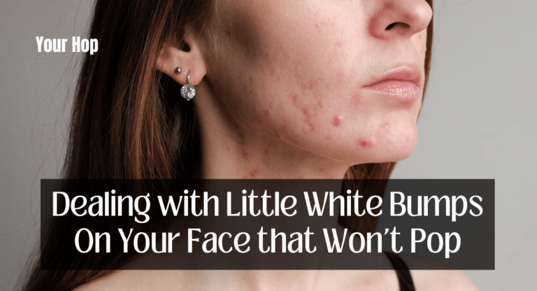 Dealing with Little White Bumps On Your Face that Won't Pop