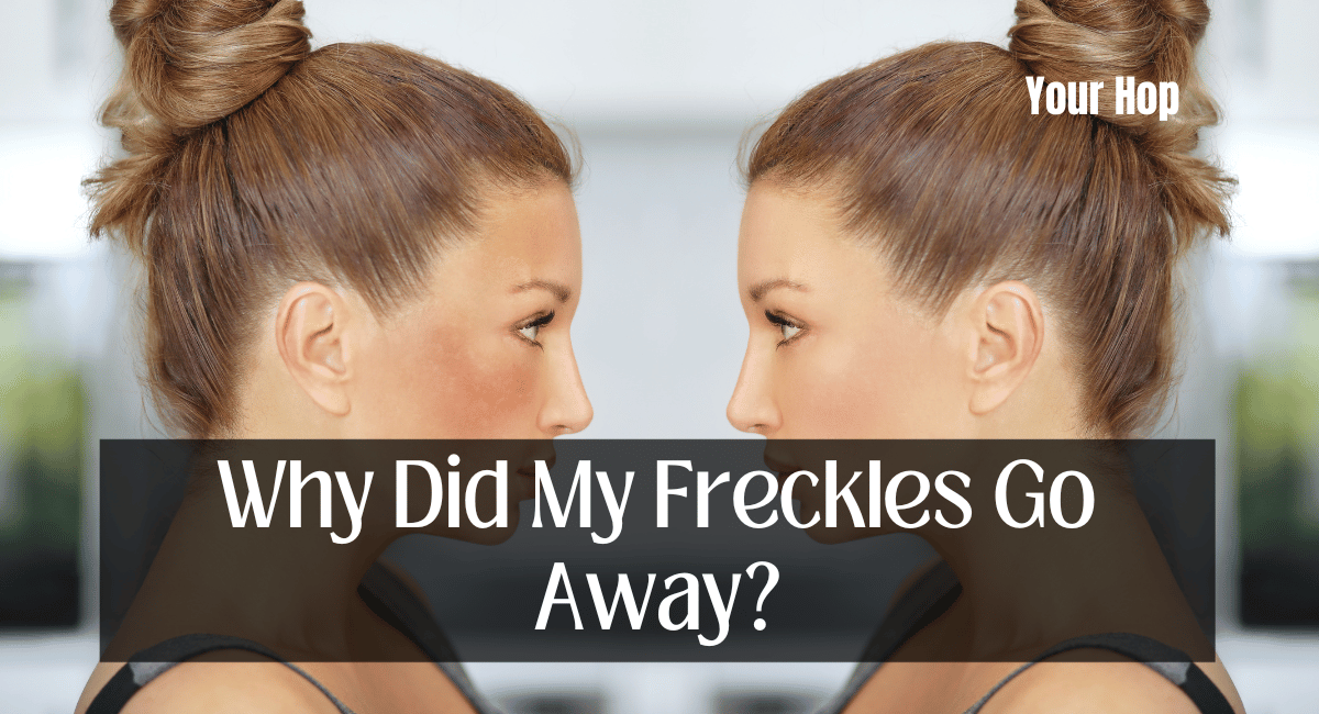 Why Did My Freckles Go Away?